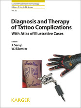 Diagnosis and Therapy of Tattoo Complications - With Atlas of Illustrative Cases