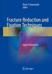 Fracture Reduction and Fixation Techniques - Upper Extremities